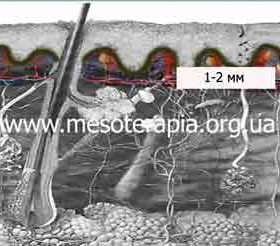 інтрабазально поверхово