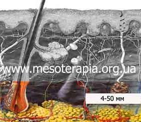 інтрагіподермально