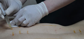 клініка мезотерапії