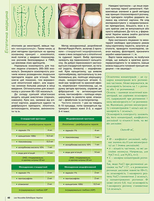 гіпоосмолярний ліполіз