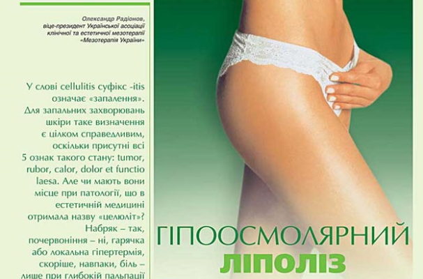 гипоосмолярный липолиз