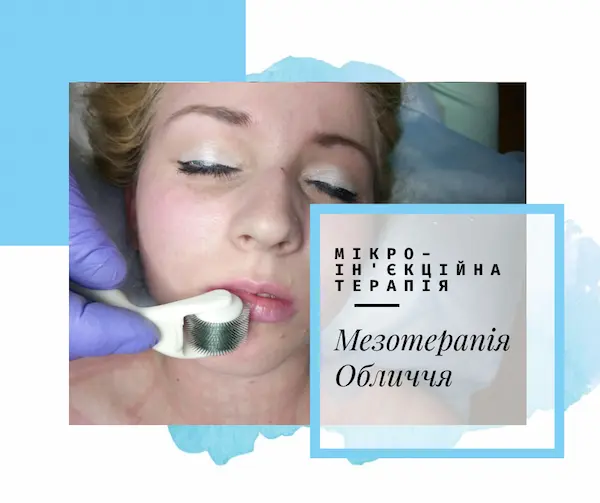 мезотерапія обличчя