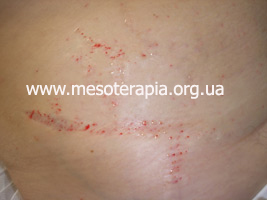 ручна техніка наппаж