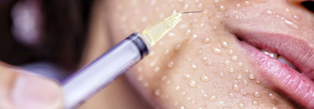 мезотерапия лица