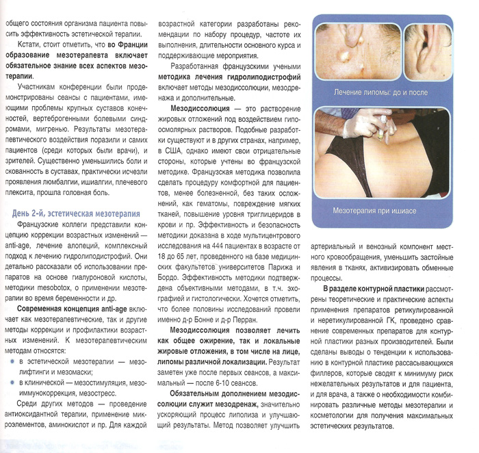 3 кити мезотерапії